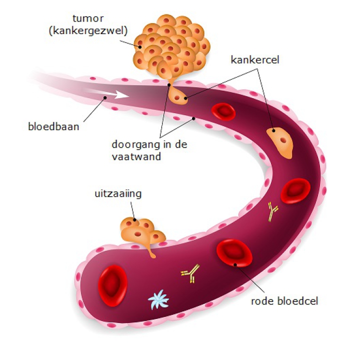 Een tumorcel kan door de vaatwand in de bloedbaan komen. Zo kan de kankercel zich verspreiden en elders in het lichaam voor uitzaaiingen zorgen.